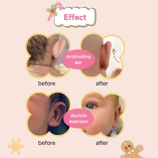 Baby Ear Flat Corrector 8 pcs