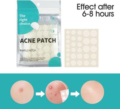 Acne Pimple Patches,Hydrocolloid Acne Patch for Covering Face, Blemishes, Zits Absorbing Patch,Cosmetics Patch for Pimple Dots, Acne Treatment, Invisible Acne Spot Patches(36 Count)