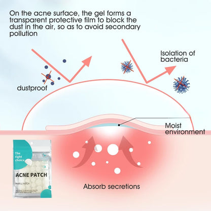 Acne Pimple Patches,Hydrocolloid Acne Patch for Covering Face, Blemishes, Zits Absorbing Patch,Cosmetics Patch for Pimple Dots, Acne Treatment, Invisible Acne Spot Patches(36 Count)