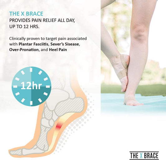 The Original X Brace - Arch Support Brace and Compression for Plantar Fasciitis, Flat Feet, Fallen Arches, Over-Pronation and Heel Pain