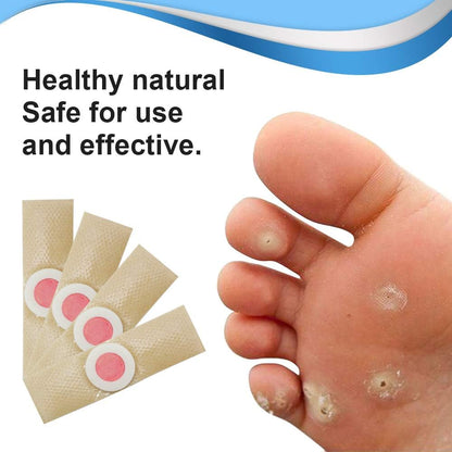 Wart Removal Plasters Pad