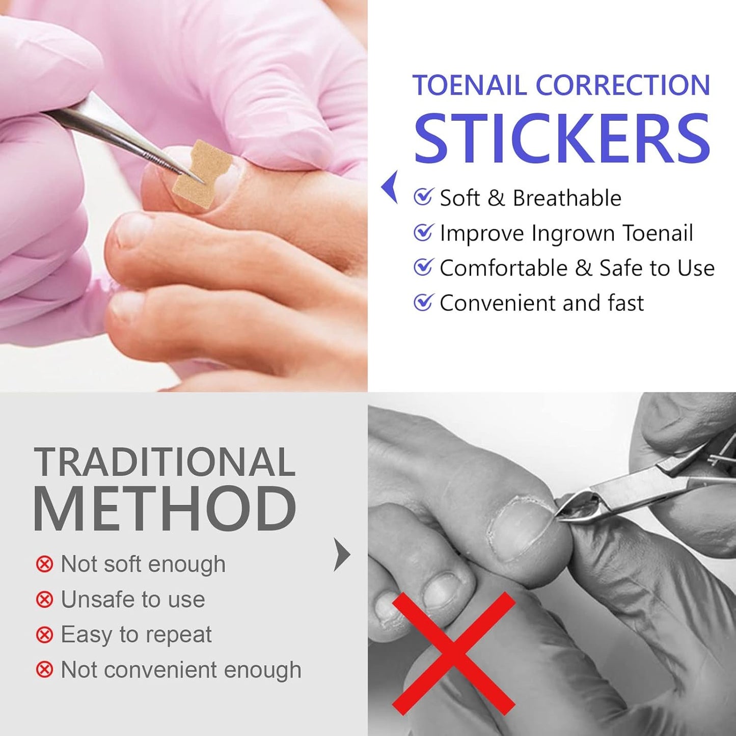 Ingrown Toenail Corrector Patch