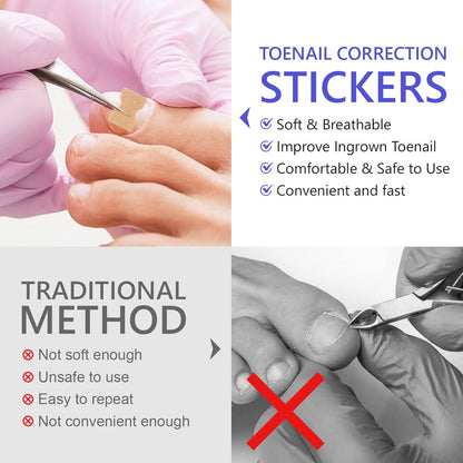 Ingrown Toenail Corrector Patch
