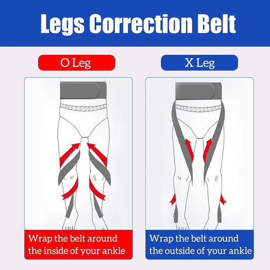 O/X Leg Type Correction Belt Leg Posture Corrector Band