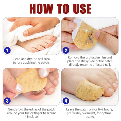 Hydrogel Fungal Nail Treatment 32 Pcs, 8-Hour Overnight Fast Acting Repair for Damaged Discolored Toenails
