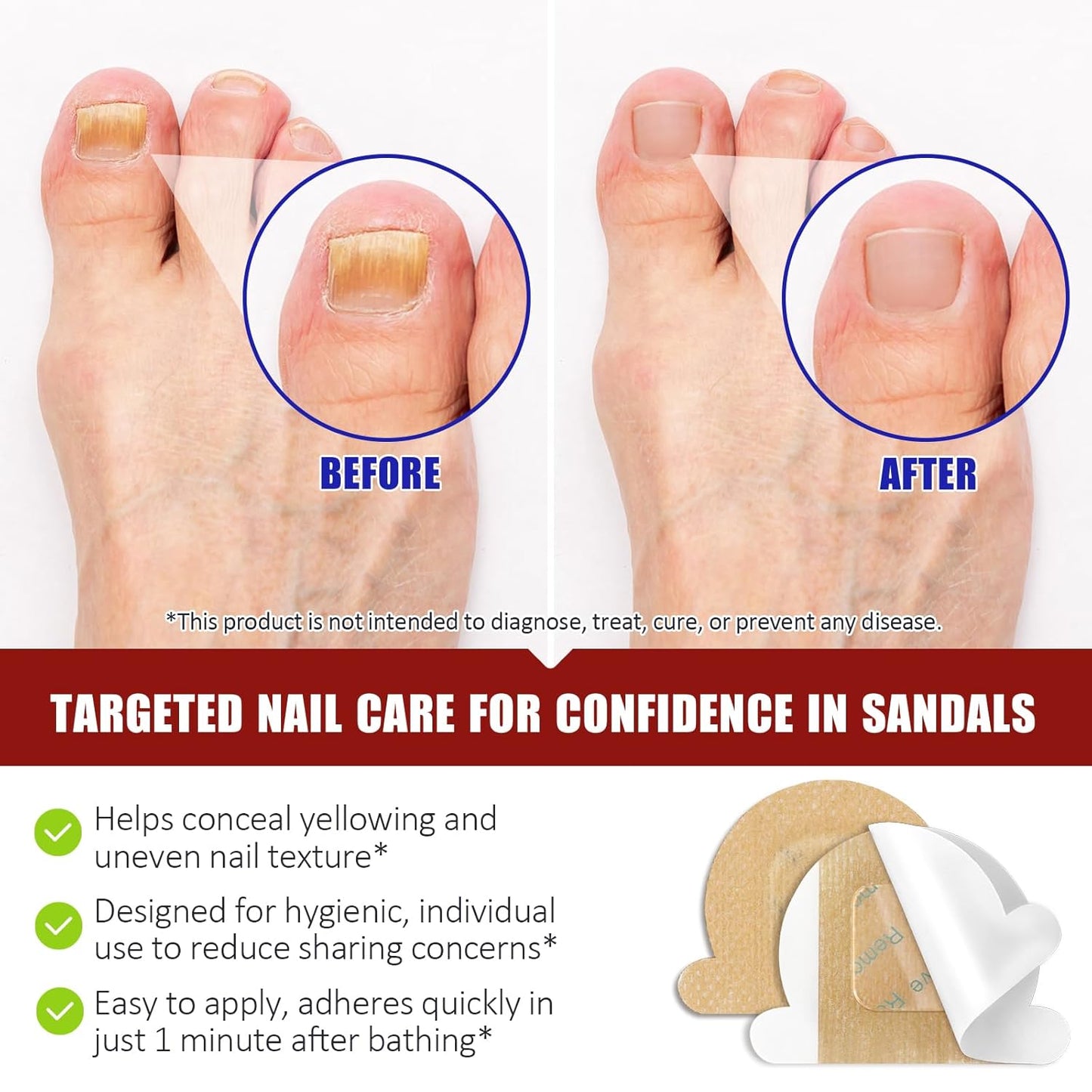 Hydrogel Fungal Nail Treatment 32 Pcs, 8-Hour Overnight Fast Acting Repair for Damaged Discolored Toenails