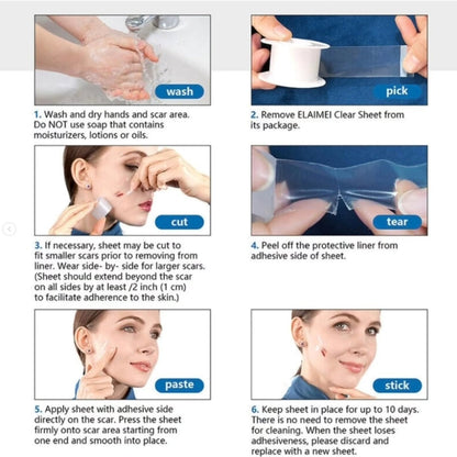 Clear Silicone Scar Sheets For Face & Body 1.5m