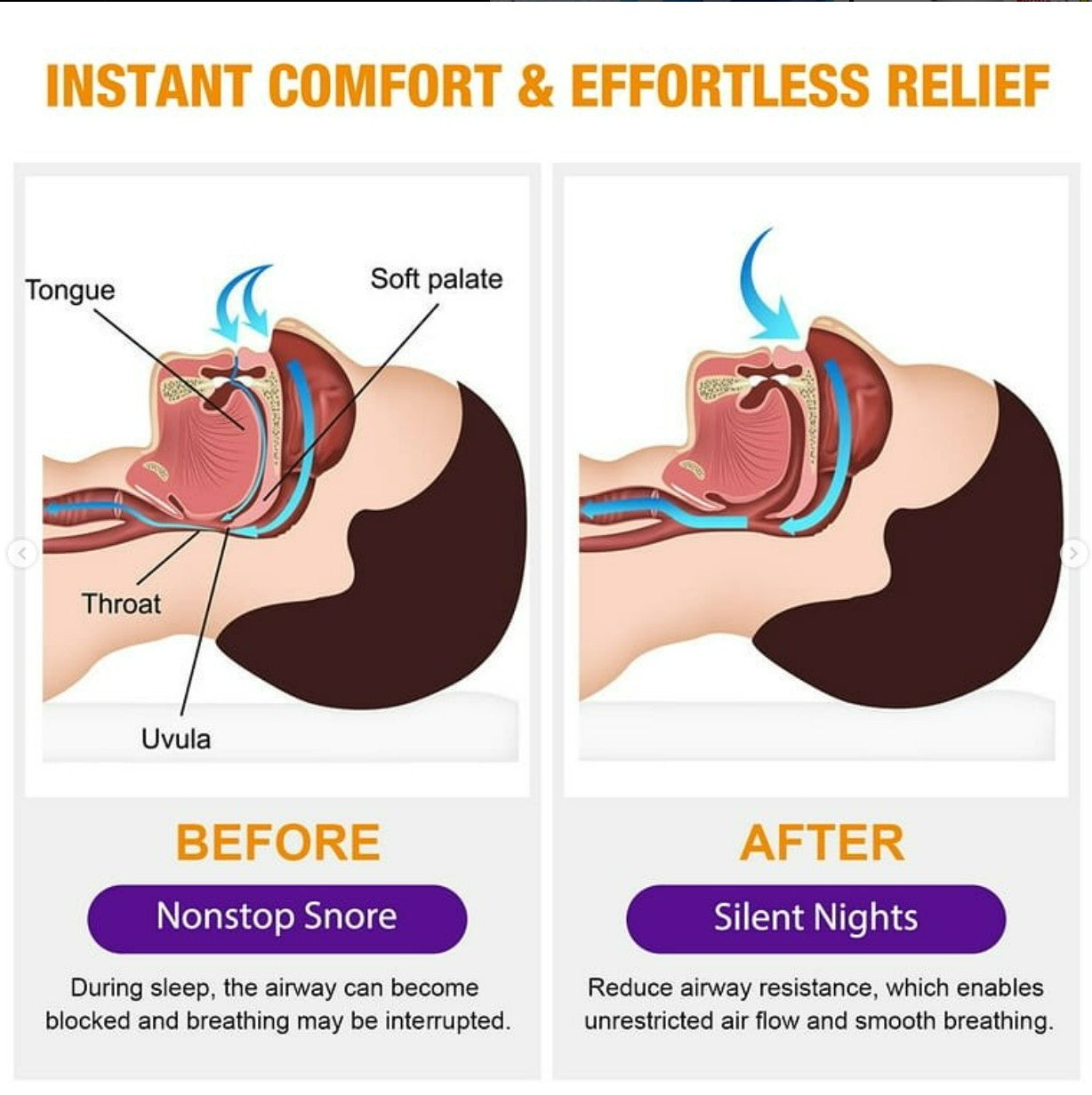 Anti-Snoring Spray