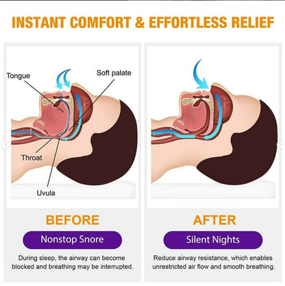 Anti-Snoring Spray