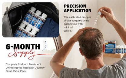Kirkland Signature Minoxidil Topical Solution USP 5%, Extra Strength Hair Regrowth Treatment For Men, 6 Months Supply